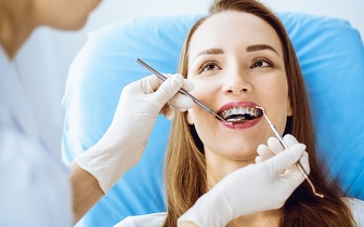 
                Aparelho Fixo Superior e Inferior + Colocação + Estudo Ortodôntico por 119€ na Trindade!
            