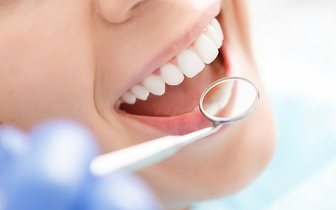 
                Limpeza Dentária: Destartarização + Polimento + Check-Up por 25€ na Pontinha!
            