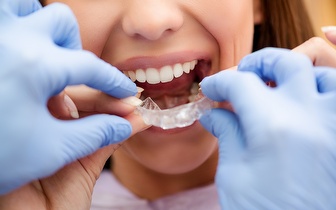 
                Branqueamento Dentário com Moldeiras + Destartarização por 69,90€ em Campo de Ourique!
            
