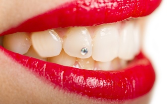 
                Aplicação de Piercing Dentário por 19€ em Campo de Ourique!
            